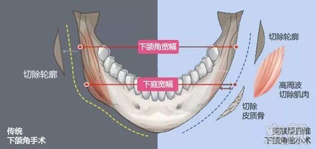 案例图片