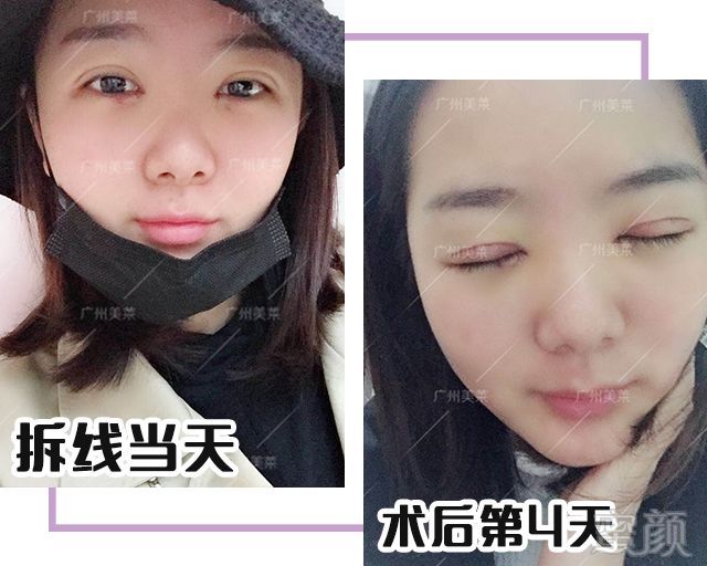 https://img.miyanlife.com/mnt/timg/180720/111QI050-0.jpg