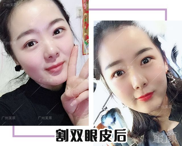 https://img.miyanlife.com/mnt/timg/180720/111QVL0-3.jpg