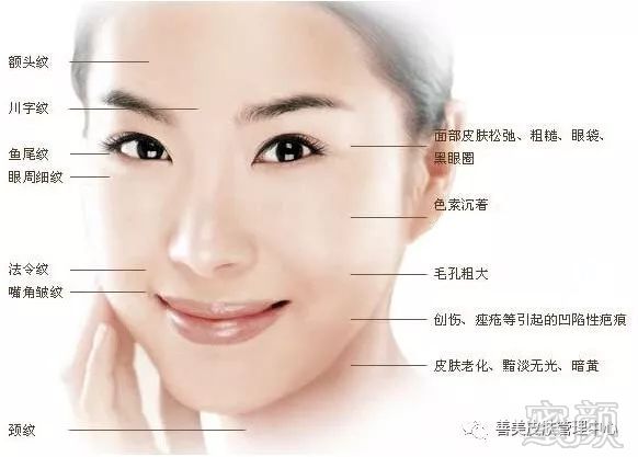 https://img.miyanlife.com/mnt/timg/180720/1122241162-0.jpg