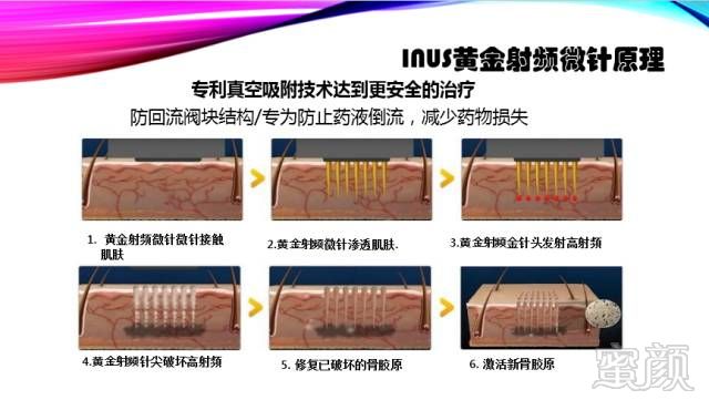 https://img.miyanlife.com/mnt/timg/180720/1123543135-7.jpg