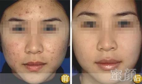 https://img.miyanlife.com/mnt/timg/180720/11235440J-9.jpg