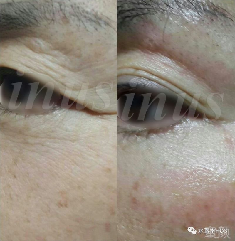 https://img.miyanlife.com/mnt/timg/180720/11235542A-12.jpg