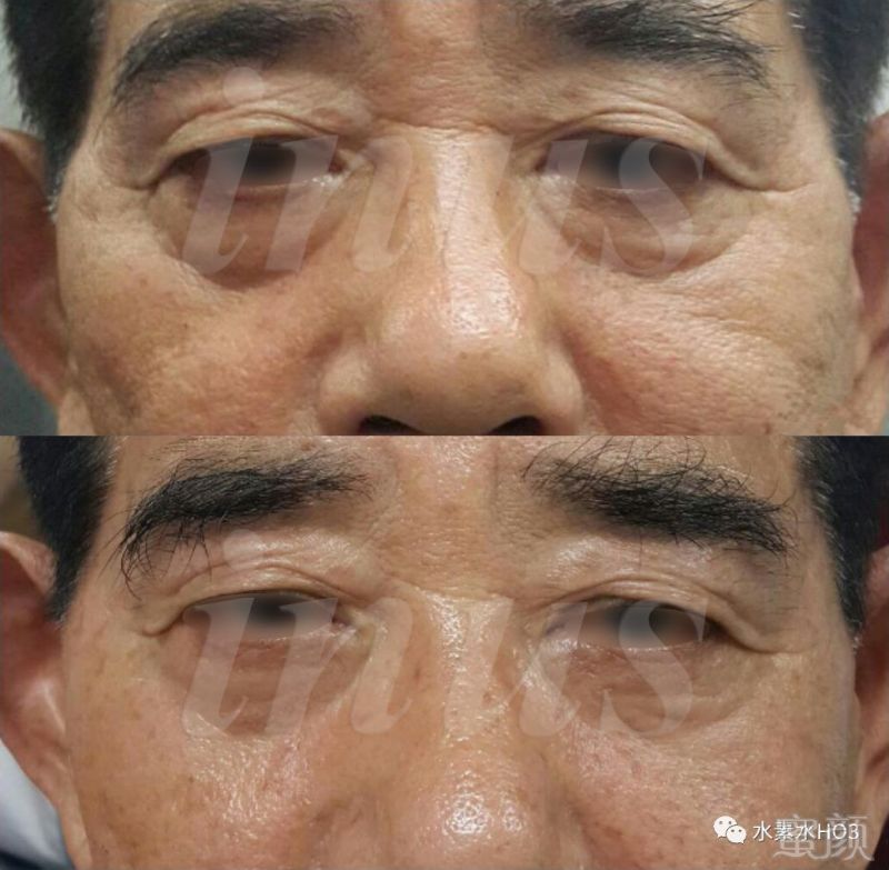 https://img.miyanlife.com/mnt/timg/180720/1123561137-13.jpg