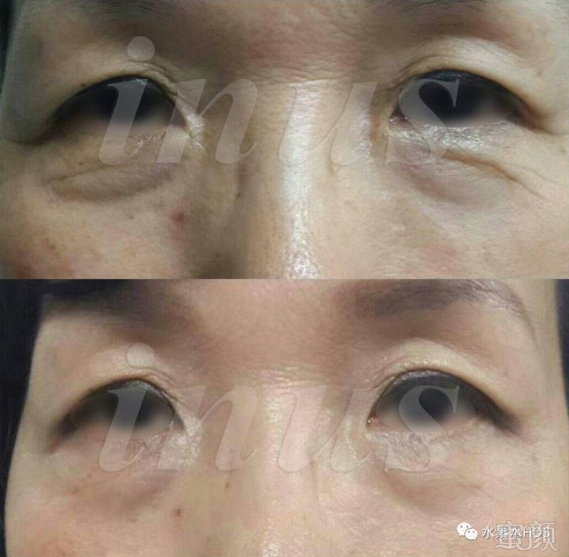 https://img.miyanlife.com/mnt/timg/180720/11235B413-14.jpg
