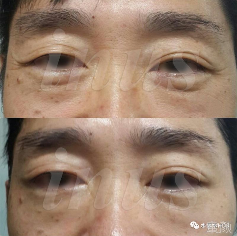 https://img.miyanlife.com/mnt/timg/180720/11235M557-15.jpg