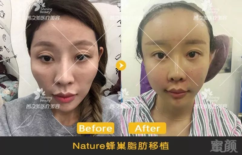 https://img.miyanlife.com/mnt/timg/180720/1136401G5-5.jpg