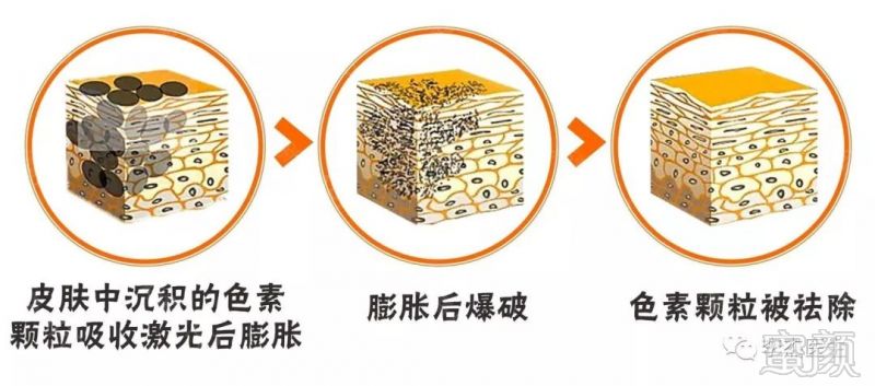 https://img.miyanlife.com/mnt/timg/180720/113K23b1-2.jpg