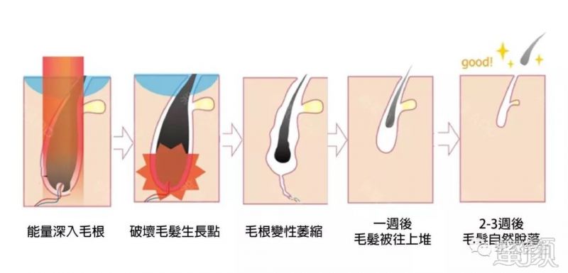https://img.miyanlife.com/mnt/timg/180720/113K36410-4.jpg