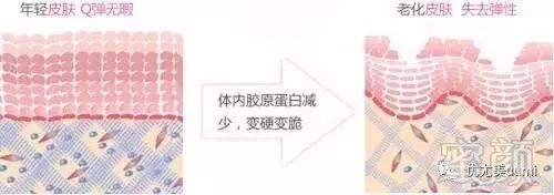https://img.miyanlife.com/mnt/timg/180720/113S93911-2.jpg