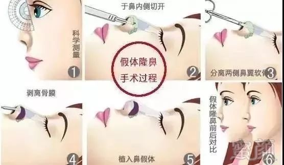 https://img.miyanlife.com/mnt/timg/180720/113Sa311-3.jpg