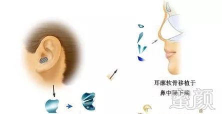 https://img.miyanlife.com/mnt/timg/180720/1140491153-4.jpg