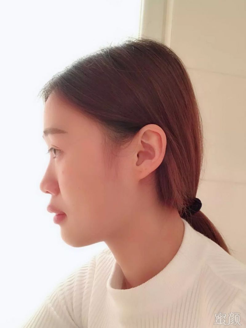 https://img.miyanlife.com/mnt/timg/180720/11404K012-0.jpg