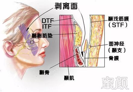 https://img.miyanlife.com/mnt/timg/180720/1140502023-7.jpg