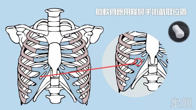 https://img.miyanlife.com/mnt/timg/180720/114050I47-6.jpg