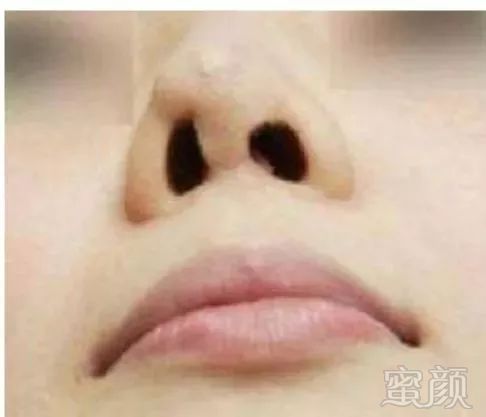 https://img.miyanlife.com/mnt/timg/180720/1142462M3-2.jpg