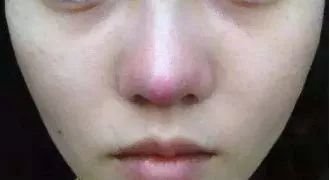 https://img.miyanlife.com/mnt/timg/180720/1142464046-4.jpg