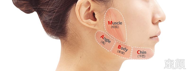 https://img.miyanlife.com/mnt/timg/180720/1144224a6-5.jpg