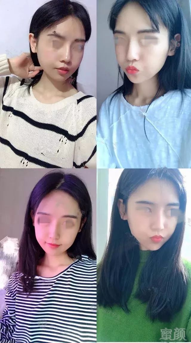 https://img.miyanlife.com/mnt/timg/180720/1144235W1-8.jpg