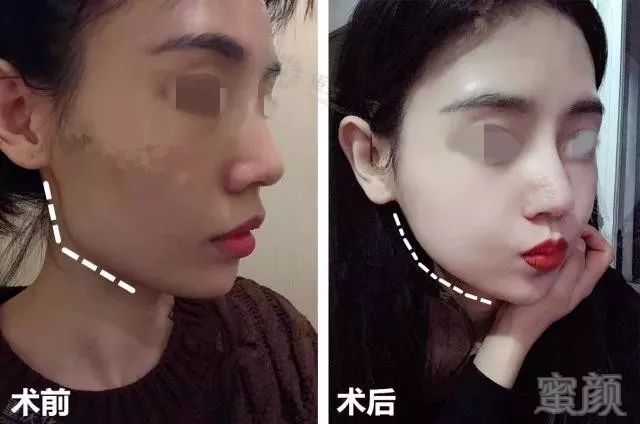 https://img.miyanlife.com/mnt/timg/180720/114423C59-7.jpg