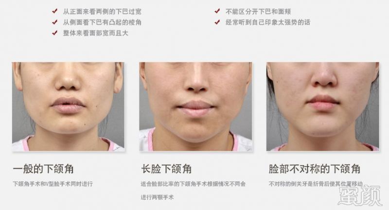 https://img.miyanlife.com/mnt/timg/180720/1144242929-10.jpg