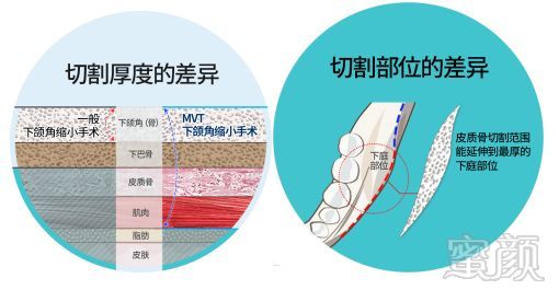 https://img.miyanlife.com/mnt/timg/180720/1144243542-12.jpg