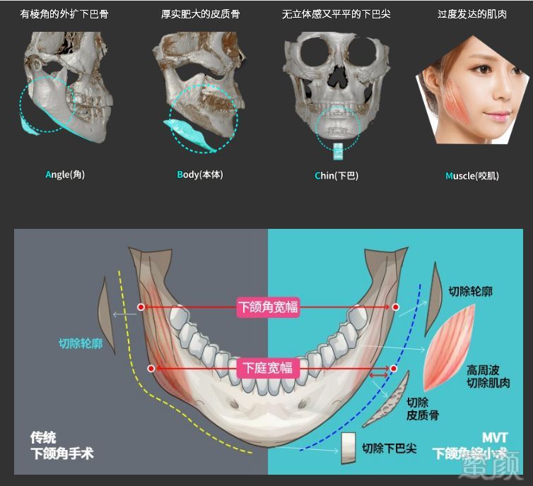 https://img.miyanlife.com/mnt/timg/180720/1144253419-15.jpg