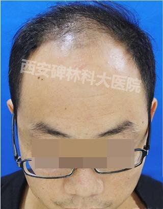 https://img.miyanlife.com/mnt/timg/180720/1151103318-3.jpg