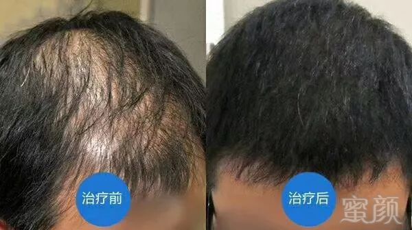 https://img.miyanlife.com/mnt/timg/180720/11511035E-1.jpg