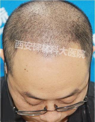 https://img.miyanlife.com/mnt/timg/180720/1151112B2-4.jpg