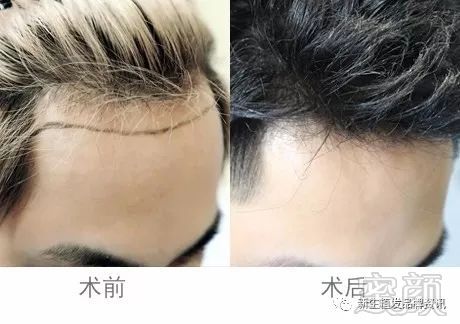 https://img.miyanlife.com/mnt/timg/180720/11515K040-1.jpg