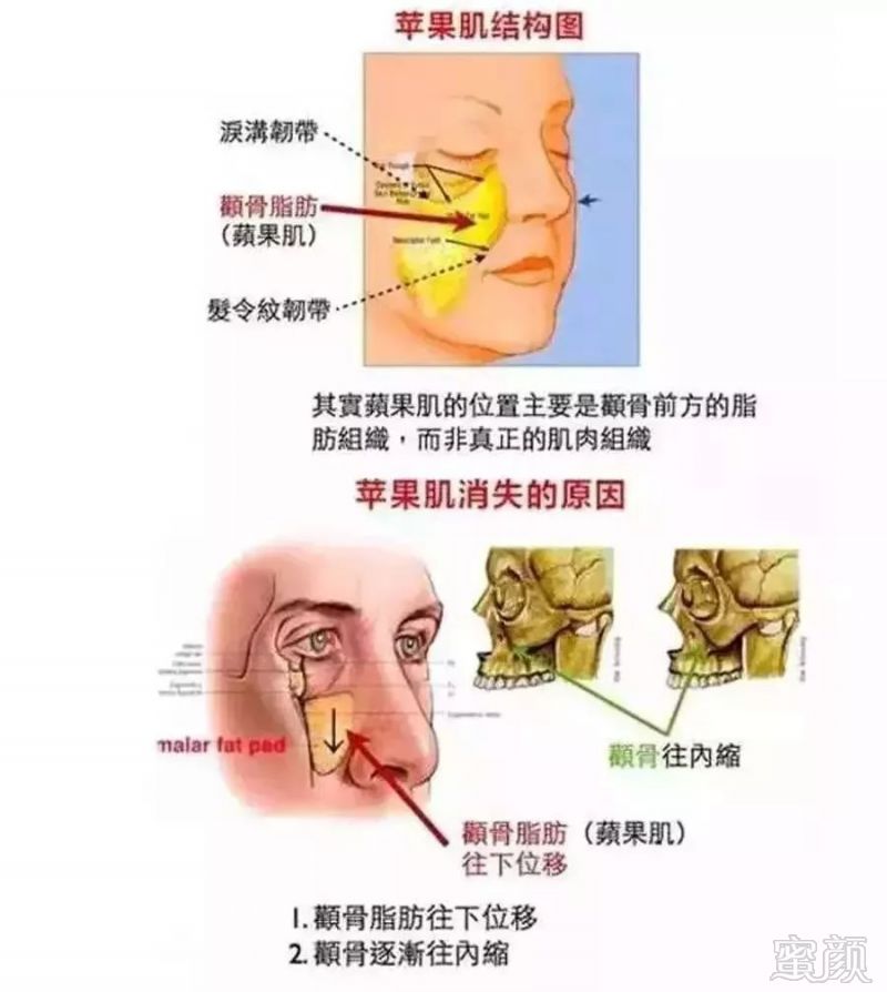 https://img.miyanlife.com/mnt/timg/180720/1204104340-5.jpg