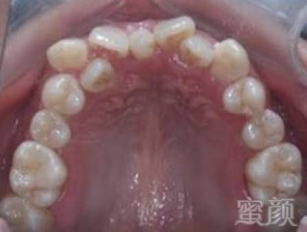 https://img.miyanlife.com/mnt/timg/180720/120FR000-0.jpg
