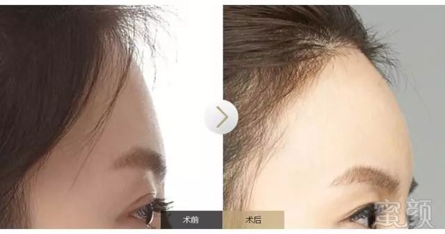 https://img.miyanlife.com/mnt/timg/180720/1210123621-5.jpg