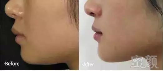 https://img.miyanlife.com/mnt/timg/180720/121012H27-6.jpg