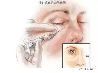 https://img.miyanlife.com/mnt/timg/180720/1215441921-4.jpg