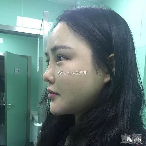 https://img.miyanlife.com/mnt/timg/180720/121623Cb-3.jpg