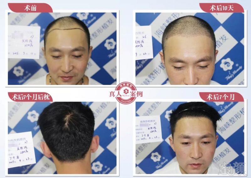 https://img.miyanlife.com/mnt/timg/180720/1221415F8-3.jpg