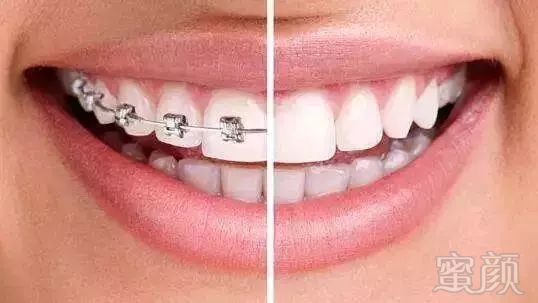 https://img.miyanlife.com/mnt/timg/180720/1222146264-3.jpg
