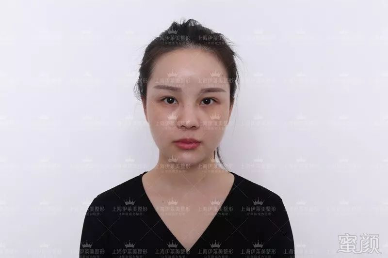 https://img.miyanlife.com/mnt/timg/180720/12232Ic9-6.jpg