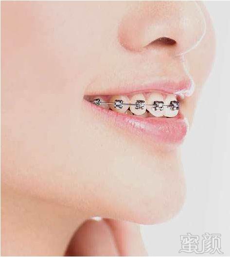 https://img.miyanlife.com/mnt/timg/180720/1225496096-6.jpg