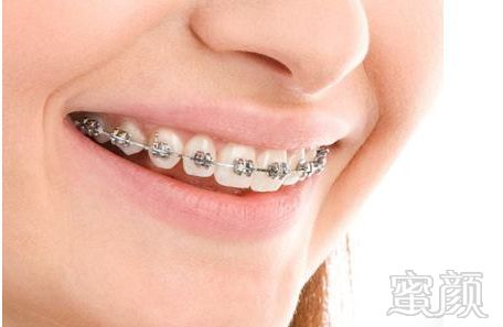 https://img.miyanlife.com/mnt/timg/180720/12254S507-0.jpg