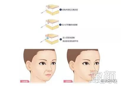 https://img.miyanlife.com/mnt/timg/180720/123F34564-1.jpg