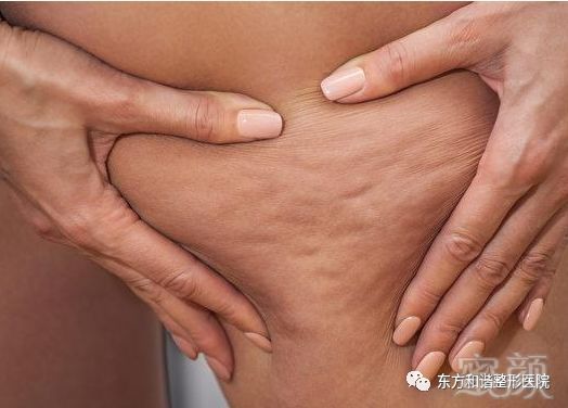https://img.miyanlife.com/mnt/timg/180720/12520T638-3.jpg