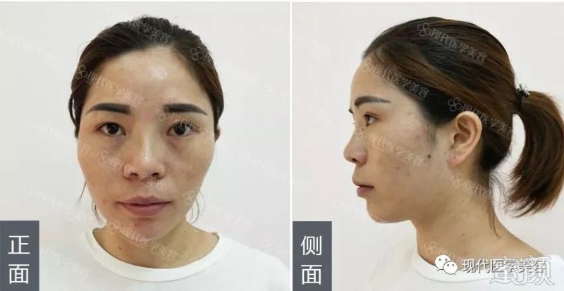 https://img.miyanlife.com/mnt/timg/180720/125324K31-3.jpg