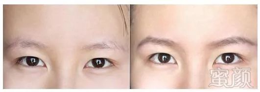 https://img.miyanlife.com/mnt/timg/180720/13012V938-1.jpg