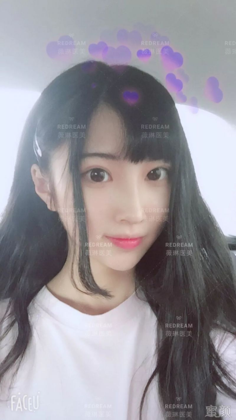 https://img.miyanlife.com/mnt/timg/180721/1042121Y1-2.jpg