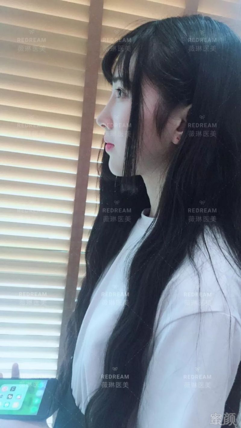 https://img.miyanlife.com/mnt/timg/180721/1042131935-3.jpg