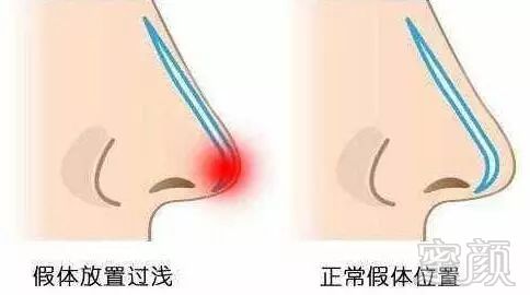 https://img.miyanlife.com/mnt/timg/180721/10423M5E-6.jpg