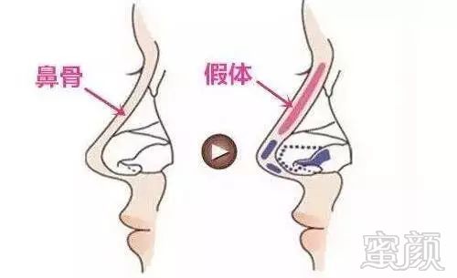 https://img.miyanlife.com/mnt/timg/180721/10423MC1-4.jpg
